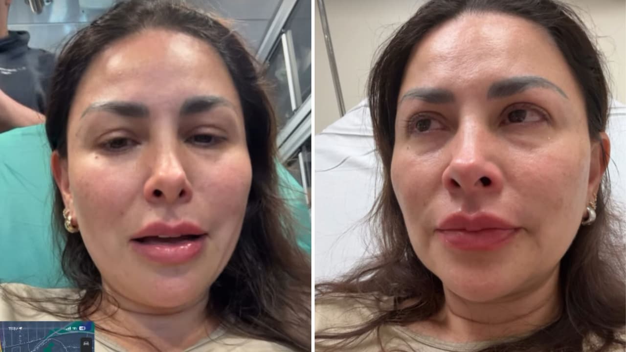 Famosa presentadora es hospitalizada tras ser atacada por un perro: “Mi pierna está destrozada”