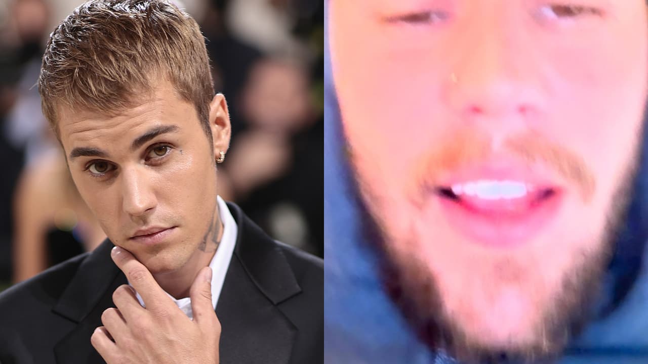 Justin Bieber admite problemas de ira y preocupa a fans con mensajes: "Estoy roto"