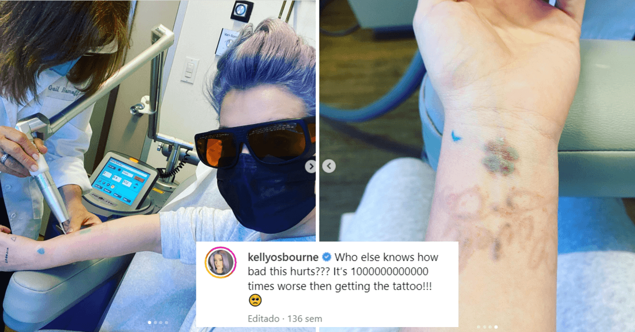 Kelly Osbourne expresó su dolor por el proceso para remover sus tatuajes
