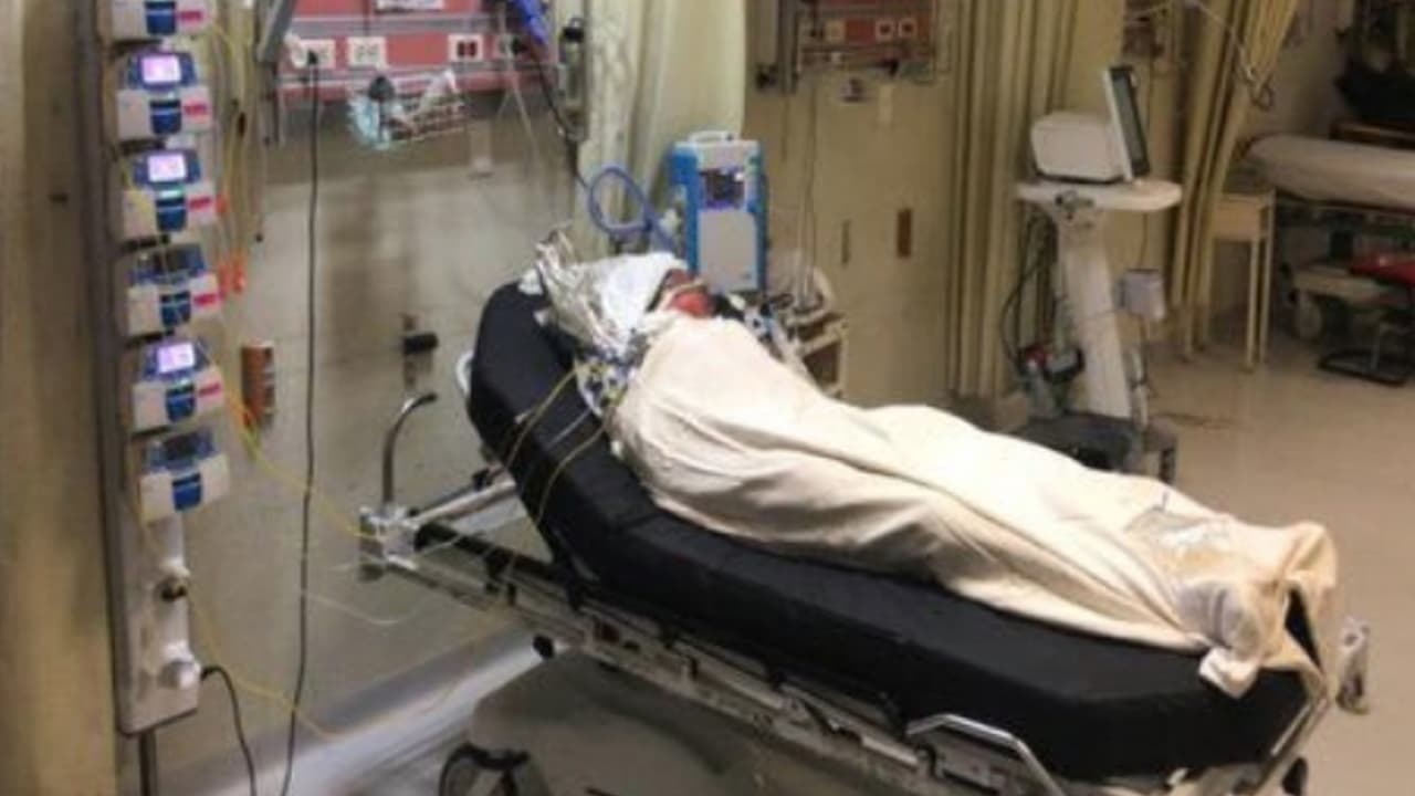 Reciben tratamiento en Texas dos menores que sufrieron quemaduras severas tras explosión de un ducto de gasolina en México