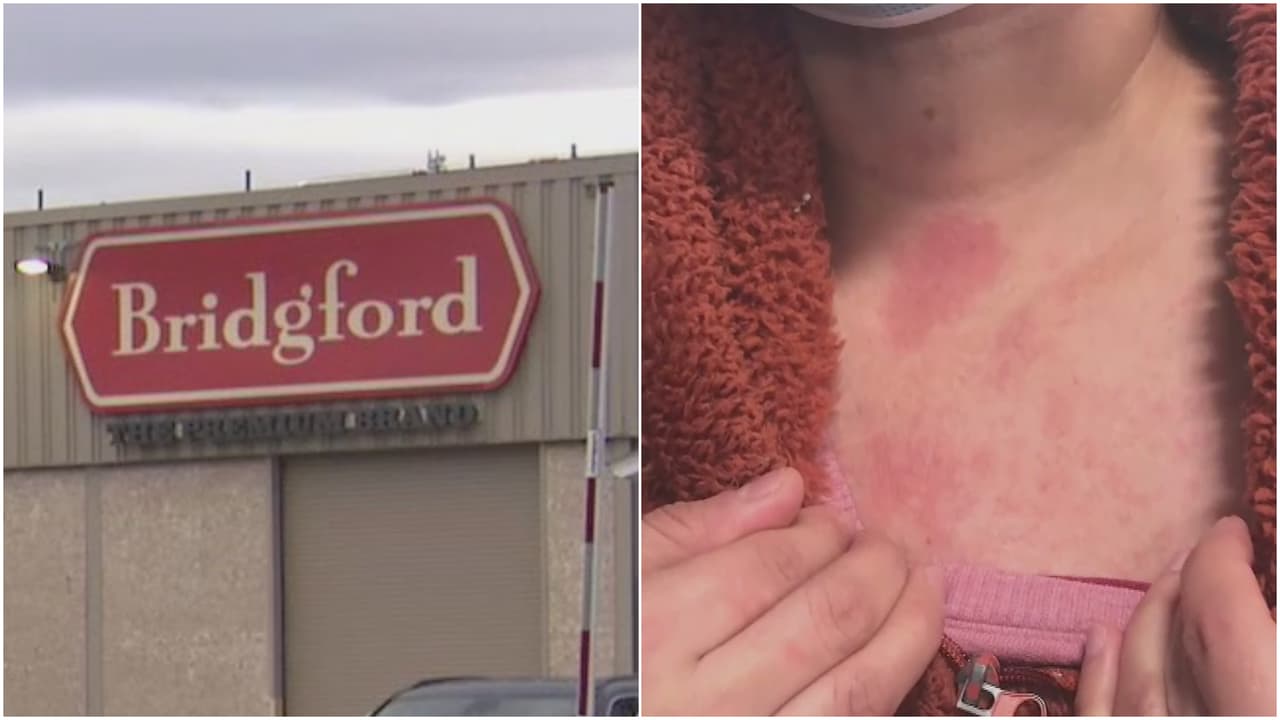 Empleados de fábrica de carnes en Las Empacadoras denuncian problemas de salud