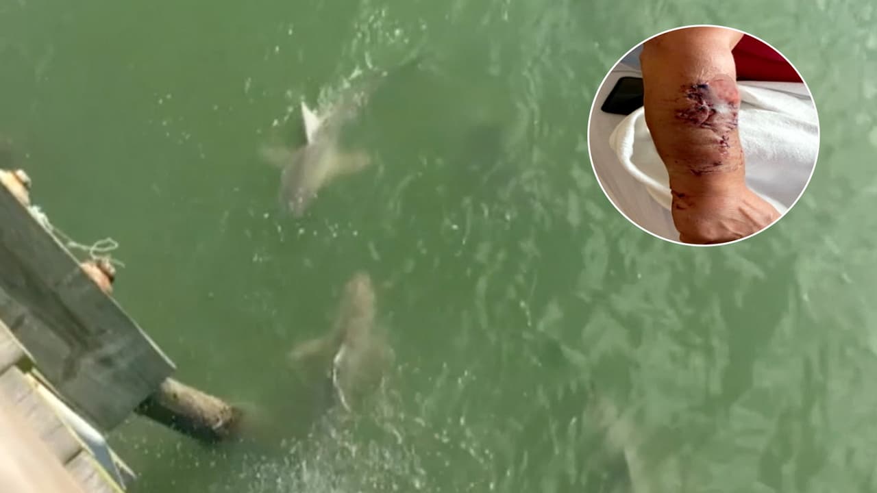 Dos ataques de tiburones en un día en la misma playa: lo que vivió una de las víctimas