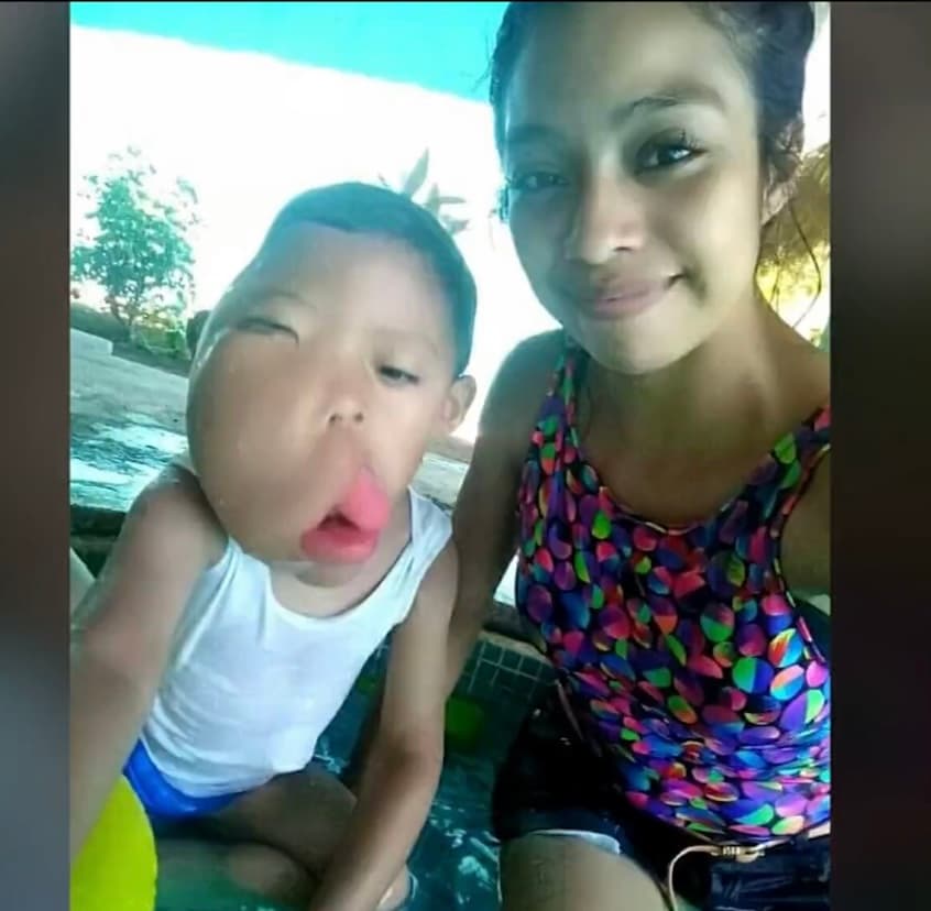 El sufrimiento por esta situación también lo viven sus familiares cercanos, quienes se preocupan por el futuro incierto y complicado que le espera al pequeño. 
<b>“Mucha gente me dice que si tuvieran un hijo así no pararían de llorar</b>; yo estuve así mucho tiempo”, afirma Álvarez. 
<br>