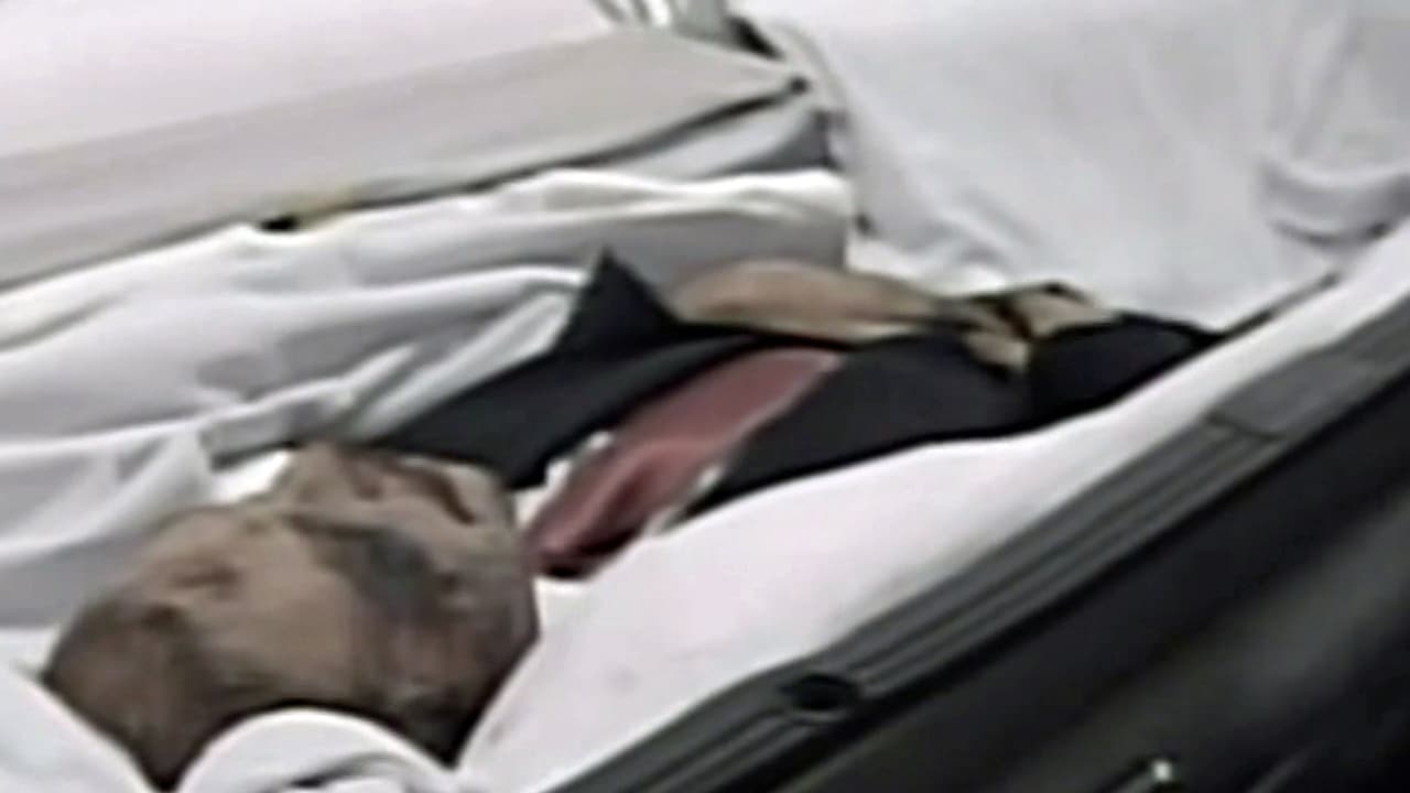 “On July 3rd, Mr. Antonio Flores Montes entered the Santa Mónica Hospital in Mexico City inorder to undergo cosmetic surgery and liposuction. The procedure was successful, the patient was transfered to room 407, where he officially passed away at 4am.