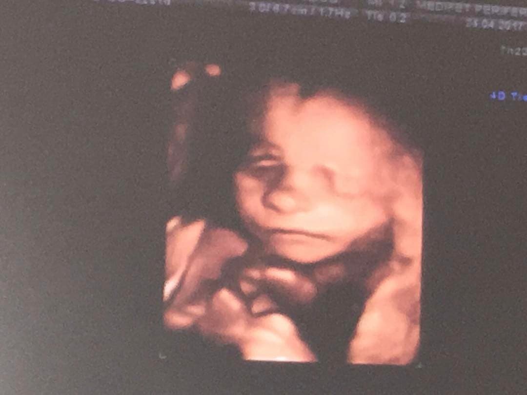 Esta fue la primera imagen del ultrasonido que compartió la actriz del pequeño Mariano, y sin ocultar su enorme felicidad le dio las gracias a su esposo e hijo por el apoyo en esta nueva etapa.