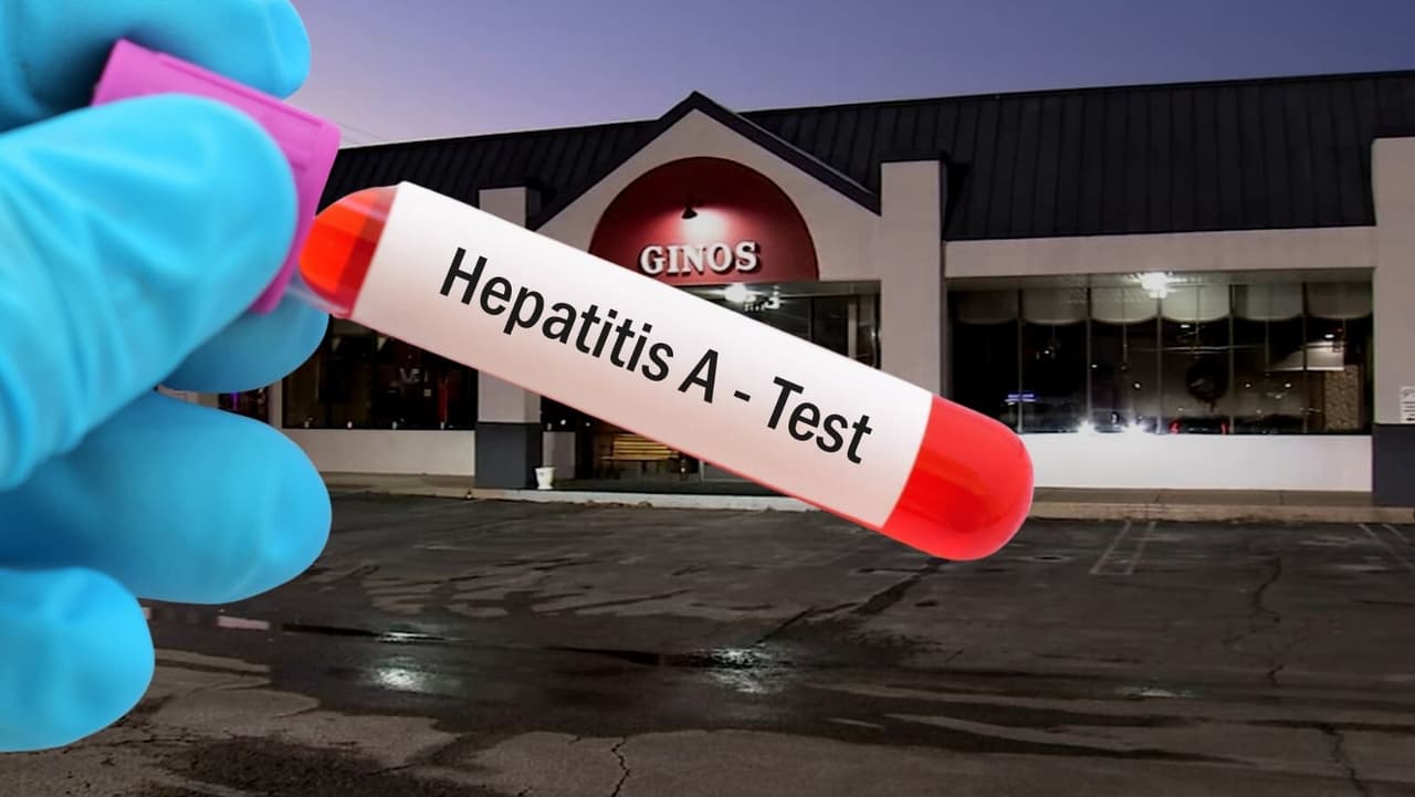 Tercera persona muere tras brote de hepatitis A en el condado de Montgomery