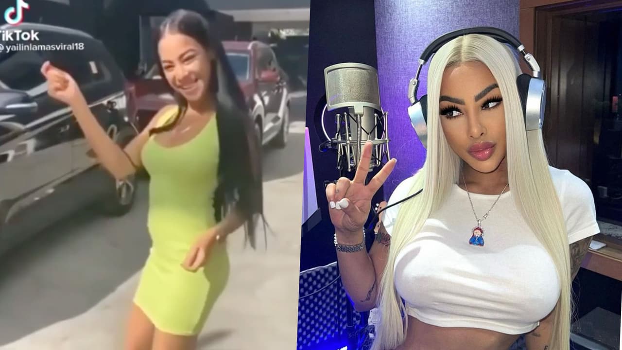 <h3 class="cms-H3-H3">Yailín ‘La más viral' </h3>
<br>
<br>La novia de Anuel AA compartió en sus redes sociales su nuevo 'arreglito’, esta vez se trata de unas ligeras modificaciones en el mentón y la nariz. Anteriormente, la intérprete de “Si Tú Me Busca” se habría hecho otras cirugías, una liposucción en el área abdominal y se rumora que también en sus glúteos, senos y labios.