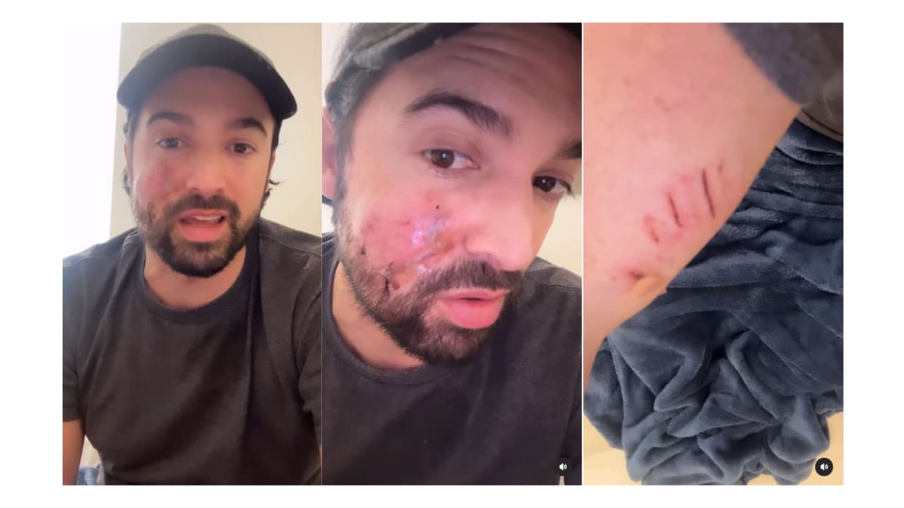 Carlos Girón se recupera tras ser mordido por un perro.