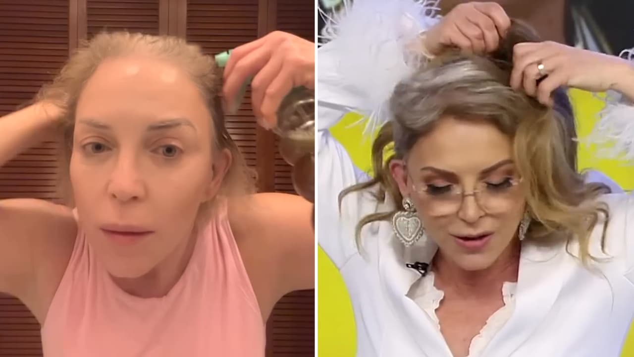 Laura Flores pone un alto a críticas por su pérdida de cabello: "La alopecia no debe avergonzar"