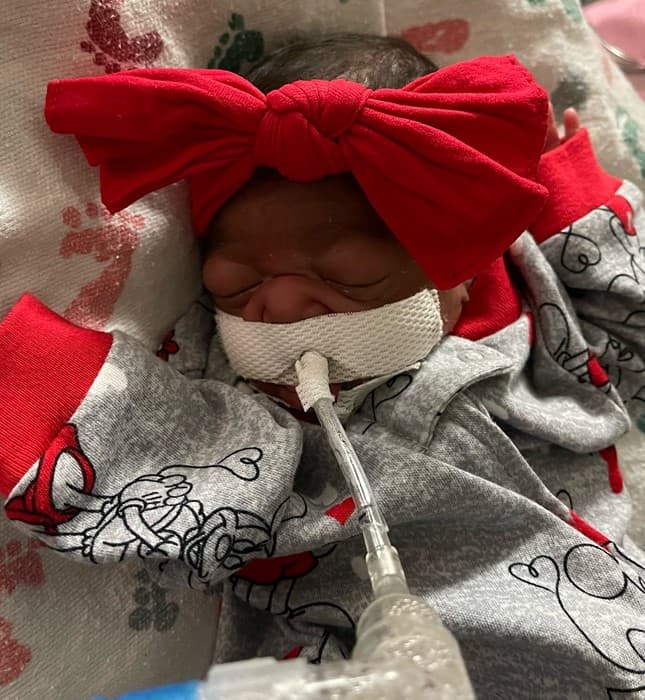 Otros bebés como Novah se mantienen conectados a un aparato para ayudarla a respirar. 
<br>