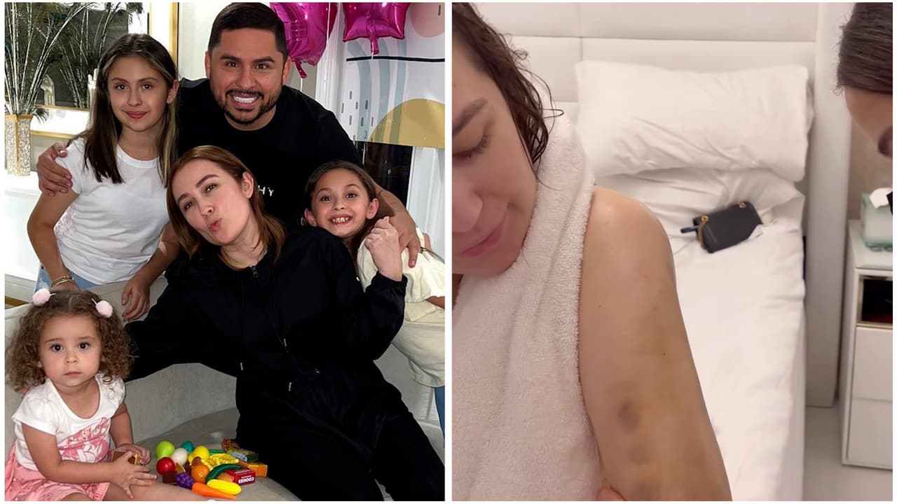 Kenia Ontiveros muestra los moretones de su ‘mommy makeover’ y admite lo difícil de su recuperación