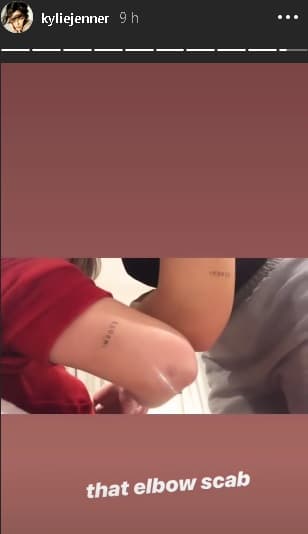 A través de las historias de
<b><a href="https://www.instagram.com/kyliejenner/" target="_blank"> Instagram</a></b>, Kylie publicó un video en el que muestra 
<b>un tatuaje en el codo</b> con el nombre de Stormi a manera de tributo para la pequeña. En el video se lee: “Esa costra del codo”.
<br>