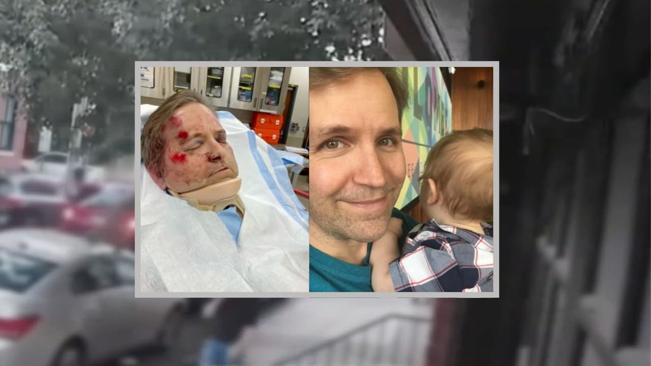 "Parte de su cráneo tuvo que ser removido": Padre de familia golpeado y robado por un grupo de adolescentes