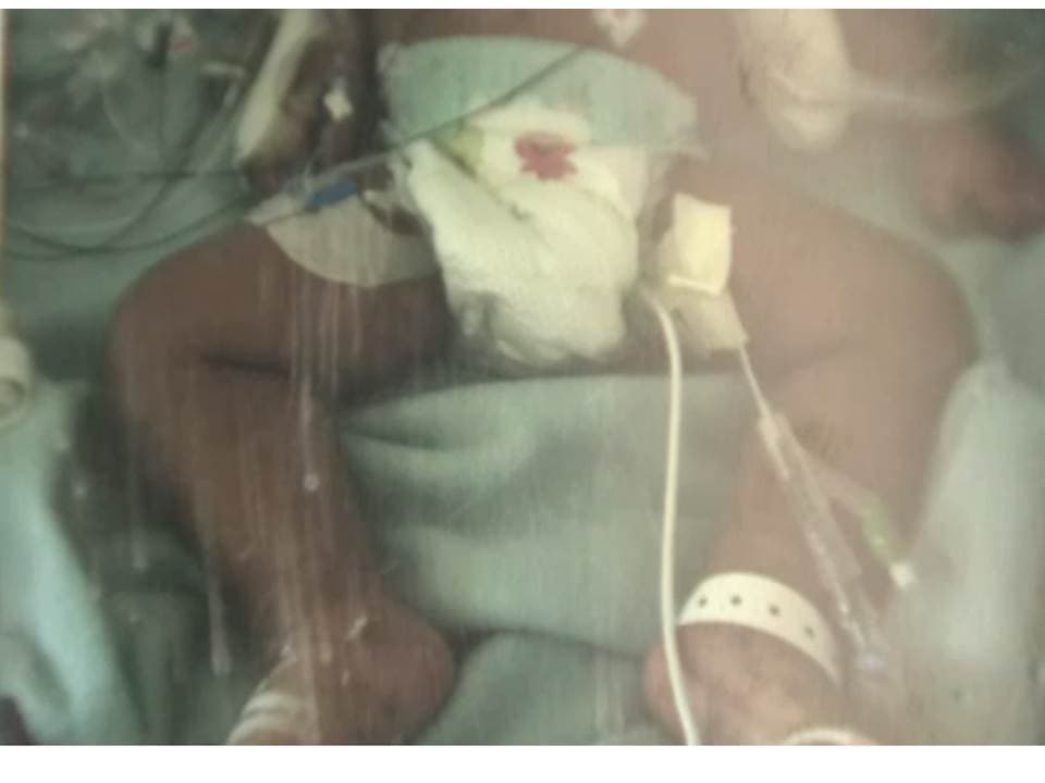 Muere un bebé maltratado que habría sido también atacado por un pitbull