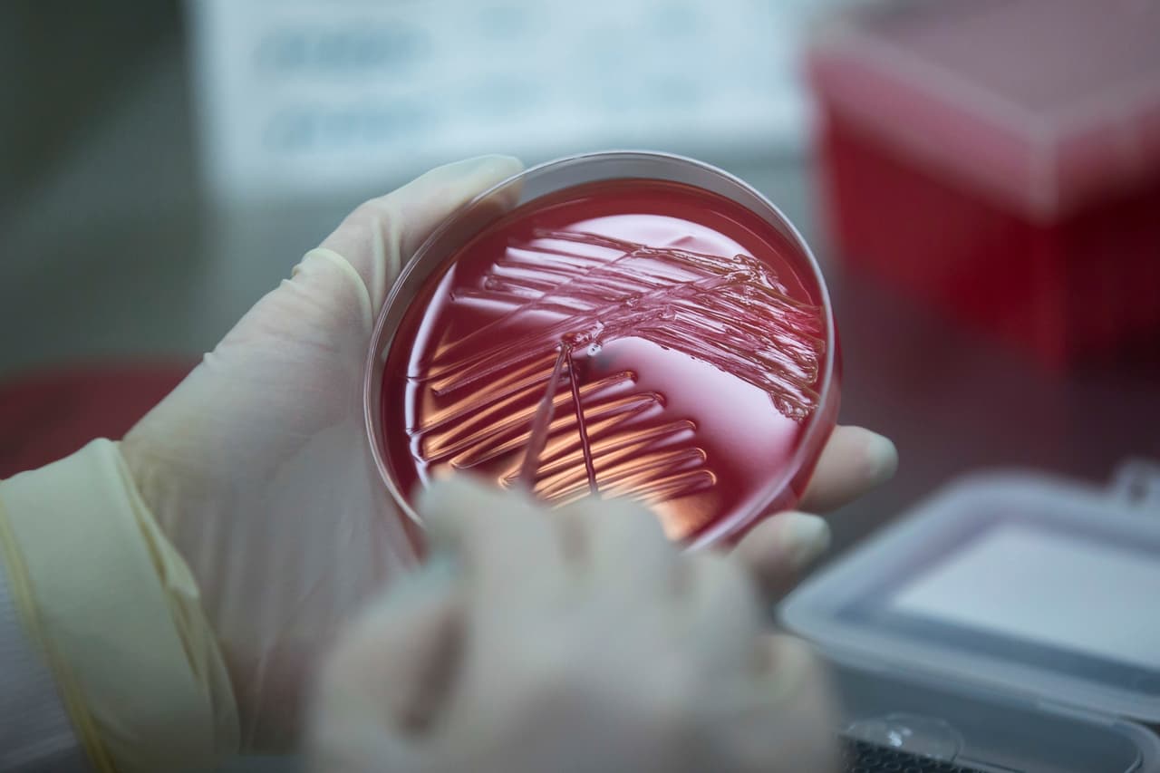 ¿Qué es? Es un metal tóxico que se usa en los combustibles fósiles y se puede combinar con otros metales para producir aleaciones que sirven para producir baterías, municiones y otros productos, explican los Centers for Disease Control. La 
<a href="http://www.who.int/mediacentre/factsheets/fs379/es/">OMS</a> advierte que también se utiliza en muchos otros productos como esmaltes cerámicos, artículos de joyería y juguetes, y en algunos productos cosméticos y medicamentos tradicionales.