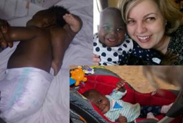 Un equipo de médicos de Chicago, entre los que se encuentran cinco cirujanos y más de 50 profesionales de salud, ayudó a realizar lo que parece un verdadero milagro.