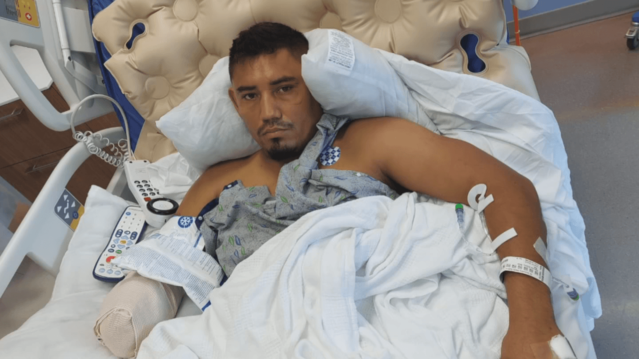 Ayuda de Impacto: Este padre perdió su mano por salvar a su hija en un tren de carga