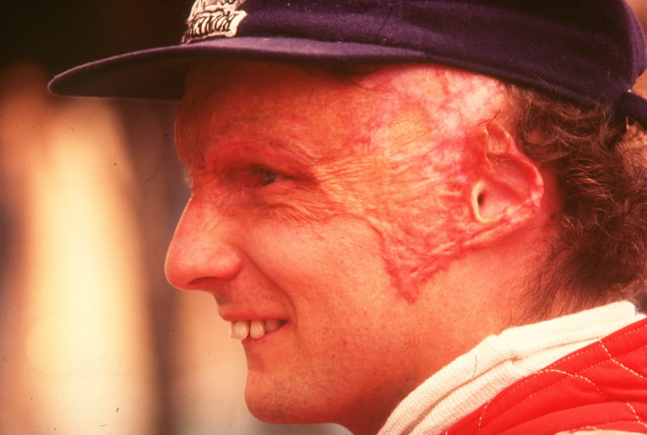 El austríaco Niki Lauda dejó un legado de títulos e historia en el automovilismo, pero su regreso tras el accidente de Nurbugring (Alemania) en el que casi pierde la vida en 1976 es un sello imborrable en la historia del deporte.