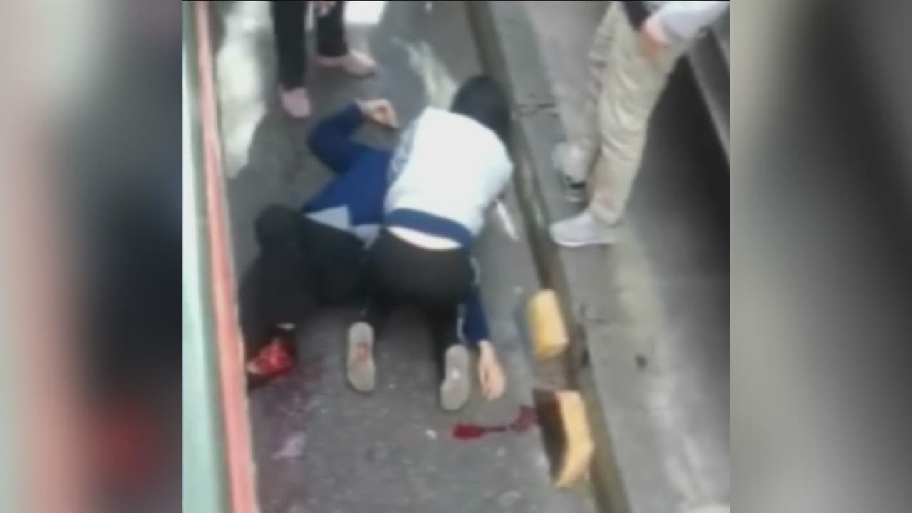 Joven de 21 años pierde una pierna tras intentar ingresar al transporte público sin pagar