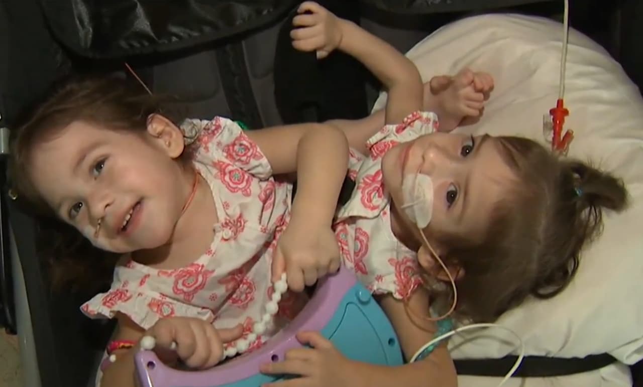 Las niñas son alimentadas con una sonda.