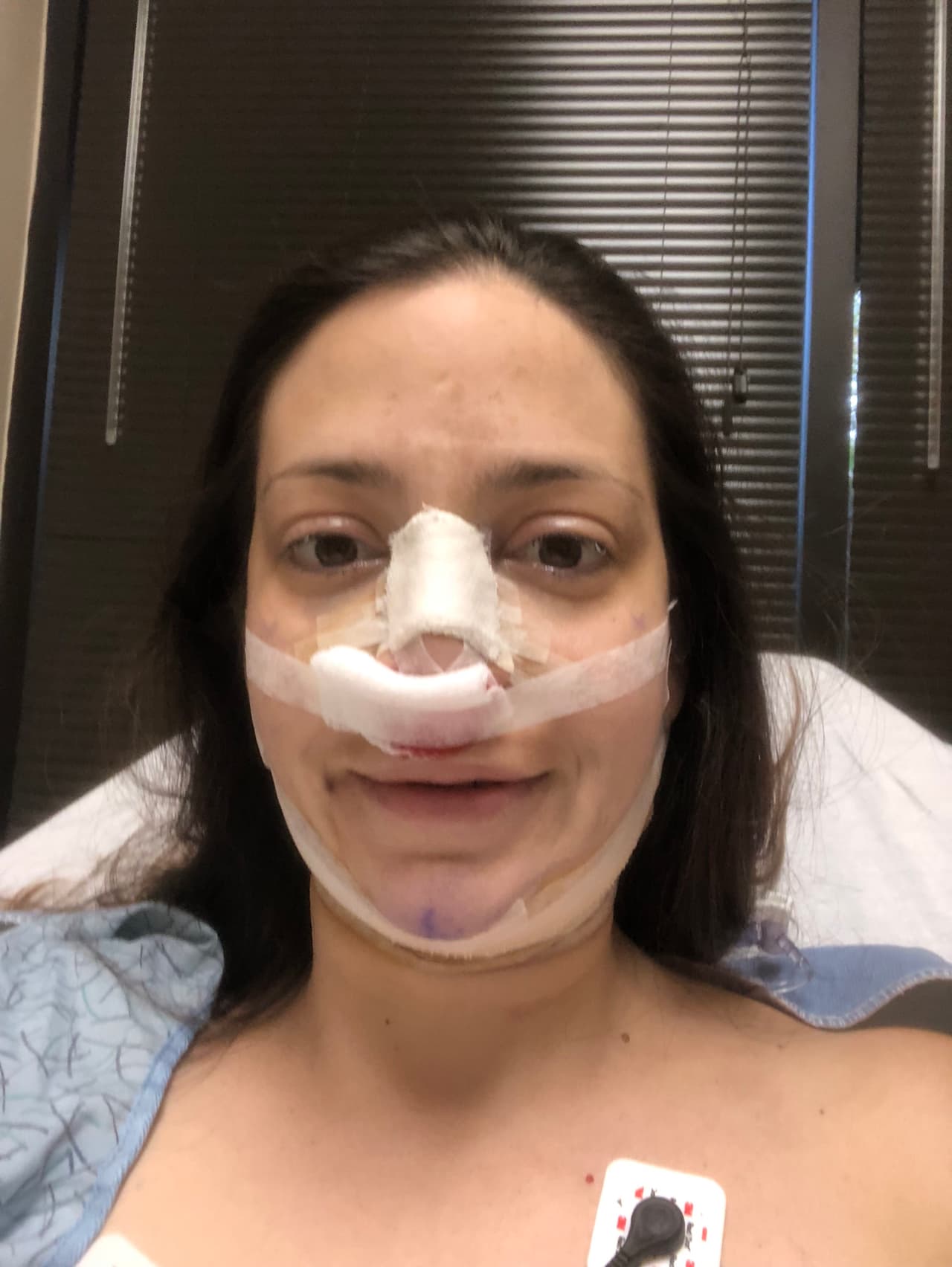 Ella es Xochytl Greer, una abogada residente en Texas en los últimos meses se ha sometido a cinco cirugías para parecerse a la duquesa de Sussex, Meghan Markle. Su caso no es el único. La ahora esposa del príncipe Harry se ha convertido en el nuevo referente de belleza para las mujeres que acuden a las clínicas estéticas buscando transformar sus rasgos físicos, según confirmó a Univision el doctor Franklin Rose.