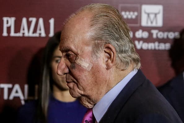 El hematoma y la hinchazón que tenía en parte de su rostro 
<b><a href="https://www.univision.com/noticias/los-memes-tras-abdicacion-del-rey-juan-carlos-fotos">no afectó el ánimo de don Juan Carlos de Borbón</a></b>, quien le heredó a su hija Elena y a sus nietos el amor por la tauromaquia.