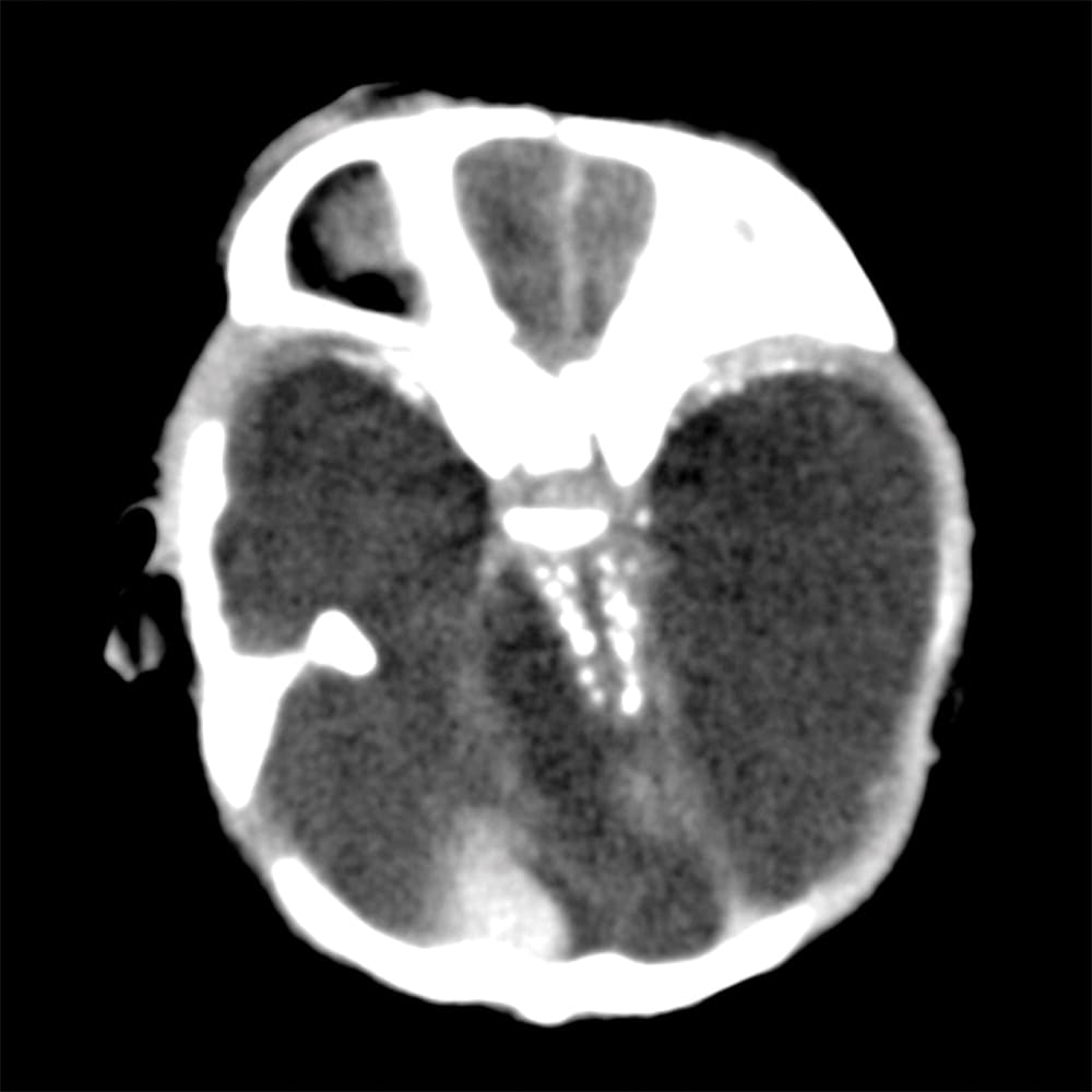 Su rostro tiene excesos de piel y su cráneo es asimétrico.