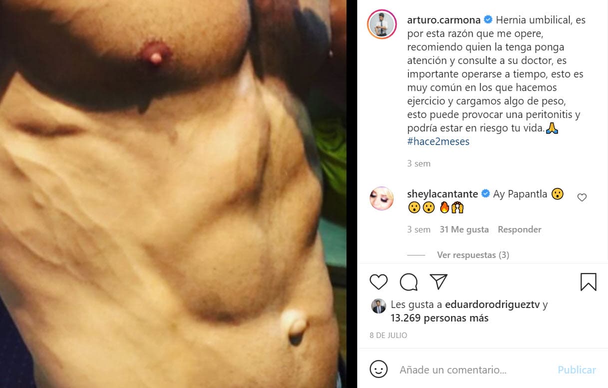 En junio pasado, dio a conocer que dos meses atrás entró a quirófano para que le fuera operada una "hernia umbilical": "Es importante operarse a tiempo, esto es muy común en los que hacemos ejercicio y cargamos algo de peso, esto puede provocar una peritonitis y
<b><a href="https://www.instagram.com/p/CRFGlvvB5-I/?utm_source=ig_embed&ig_rid=19df2c48-3632-4f6f-8454-68c6bdfc2e4c" target="_blank">podría estar en riesgo tu vida</a></b>", escribió en Instagram.
<br>
