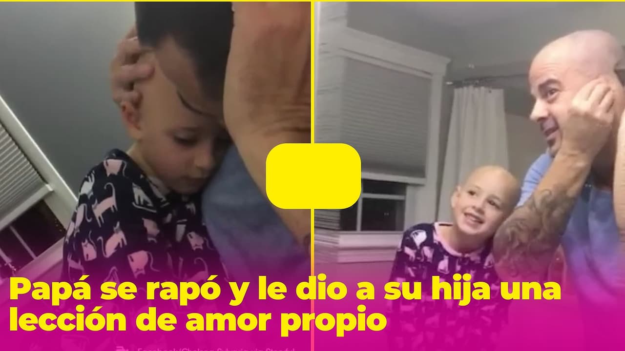 Un padre se rapó la cabeza para enseñarle a su hija una lección sobre amor propio