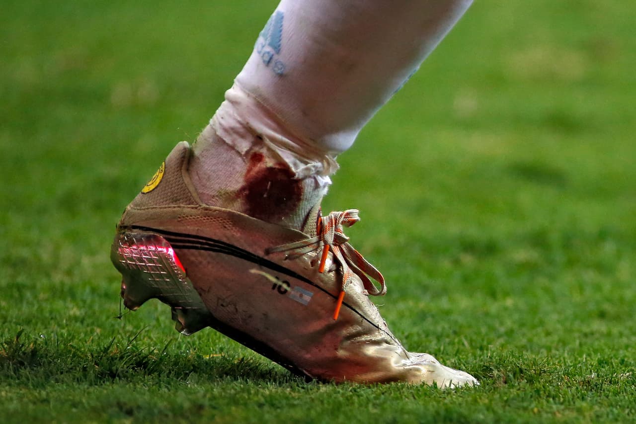 Messi siguió jugando para llevar a la Albiceleste a la Final.