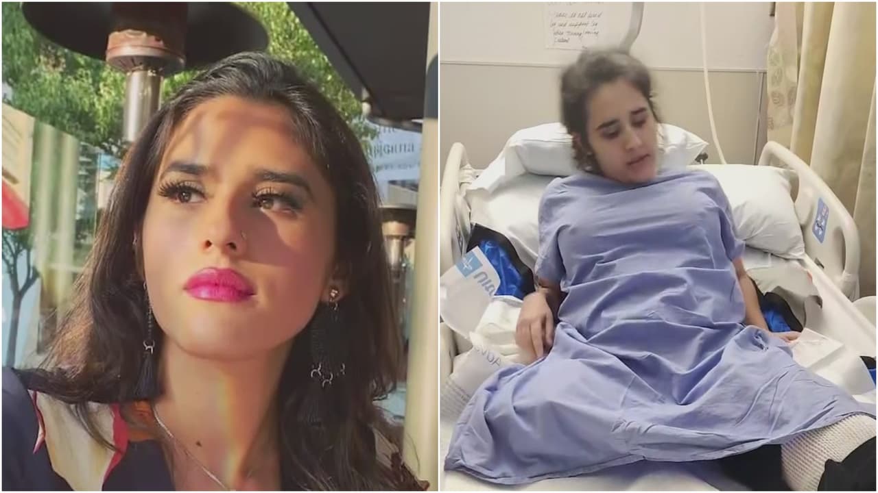 Hispana pierde su pierna tras ser atropellada por conductor ebrio y podría perder la otra extremidad