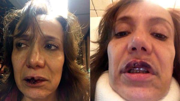 Carranza, con las secuelas de la golpiza en su rostro.