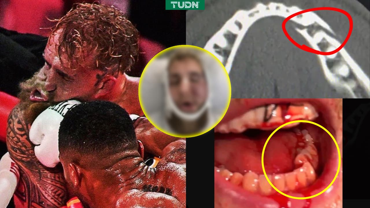 Así quedó el rostro de Jake Paul tras su pelea ante Anthony Joshua