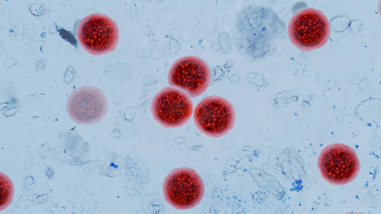 Reportan casi 50 casos de ciclosporiasis en Utah: ¿Cuántos están relacionados con viajes?