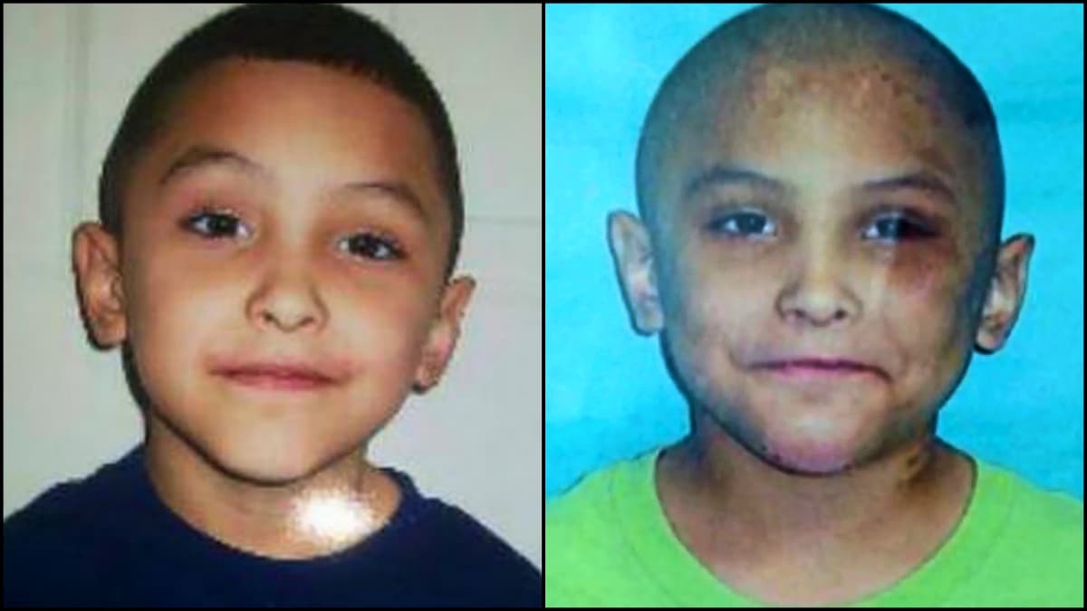 <b>Gabriel Fernández, de 8 años</b>
<br>
<br>
<a href="https://www.univision.com/local/los-angeles-kmex/el-caso-de-la-muerte-gabriel-fernandez-contado-en-imagenes">Gabriel Fernández</a> murió en mayo de 2013, después de una paliza que le propinó su padrastro. De acuerdo con el informe forense, 
<b>el pequeño sufrió fractura del cráneo y en todo su cuerpo habían traumatismos</b>, tras ocho meses de continuo maltrato.
<br>
<br>
<br>