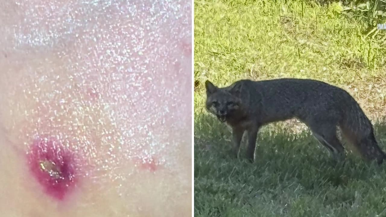 Zorro con rabia siembra el terror en la ciudad de Forsyth, donde ya son tres sus víctimas