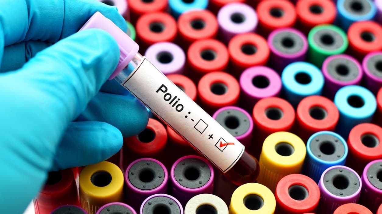 La vacuna contra la polio se aplica a los niños a los 2, 4 y 6 meses y una cuarta de refuerzo a los 4 años.