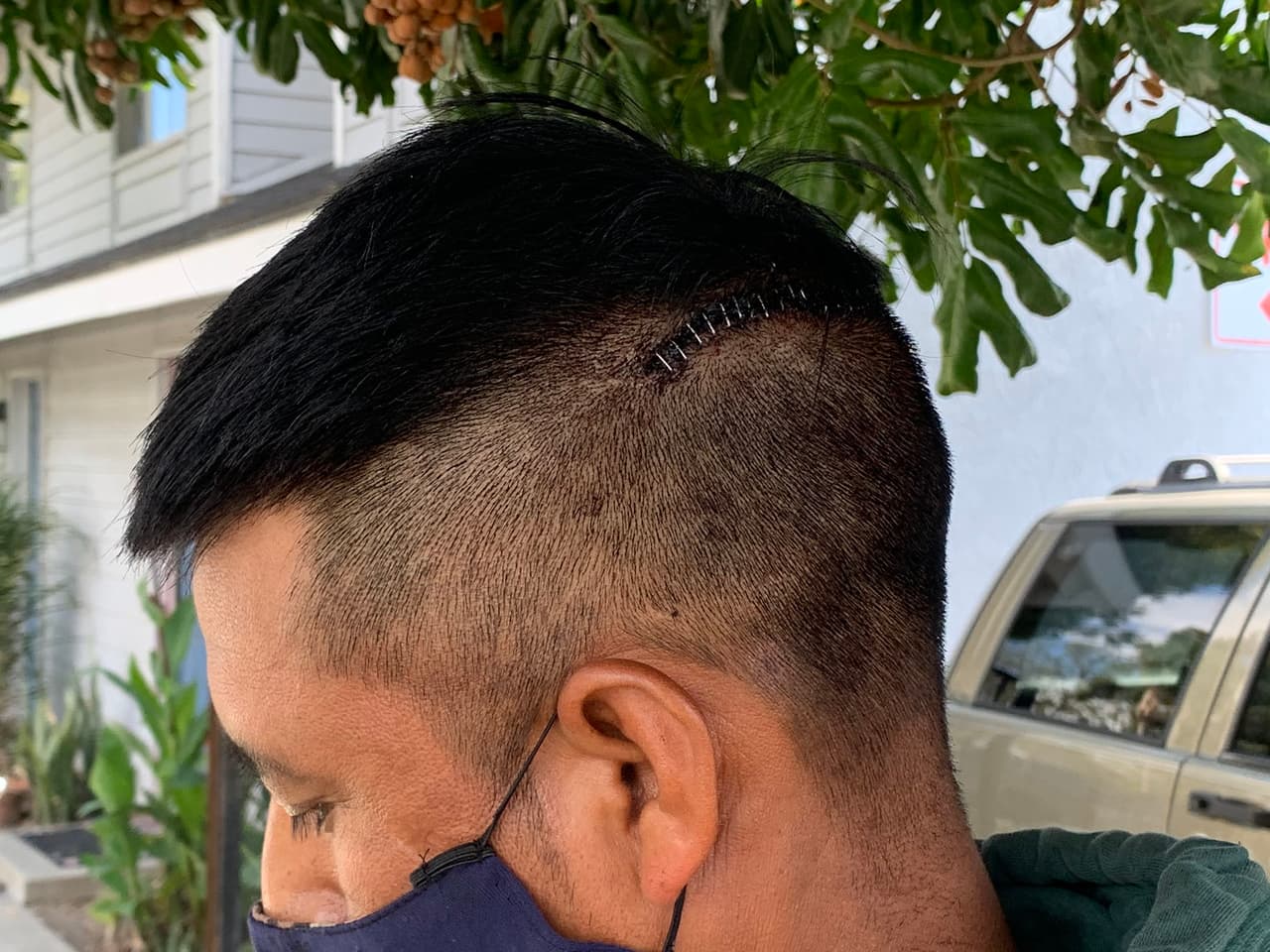 El sospechoso lo atacó con un cuchillo y lo golpeó hasta dejarlo sin posibilidades de defenderse, solo para robarle su billetera y teléfono celular.