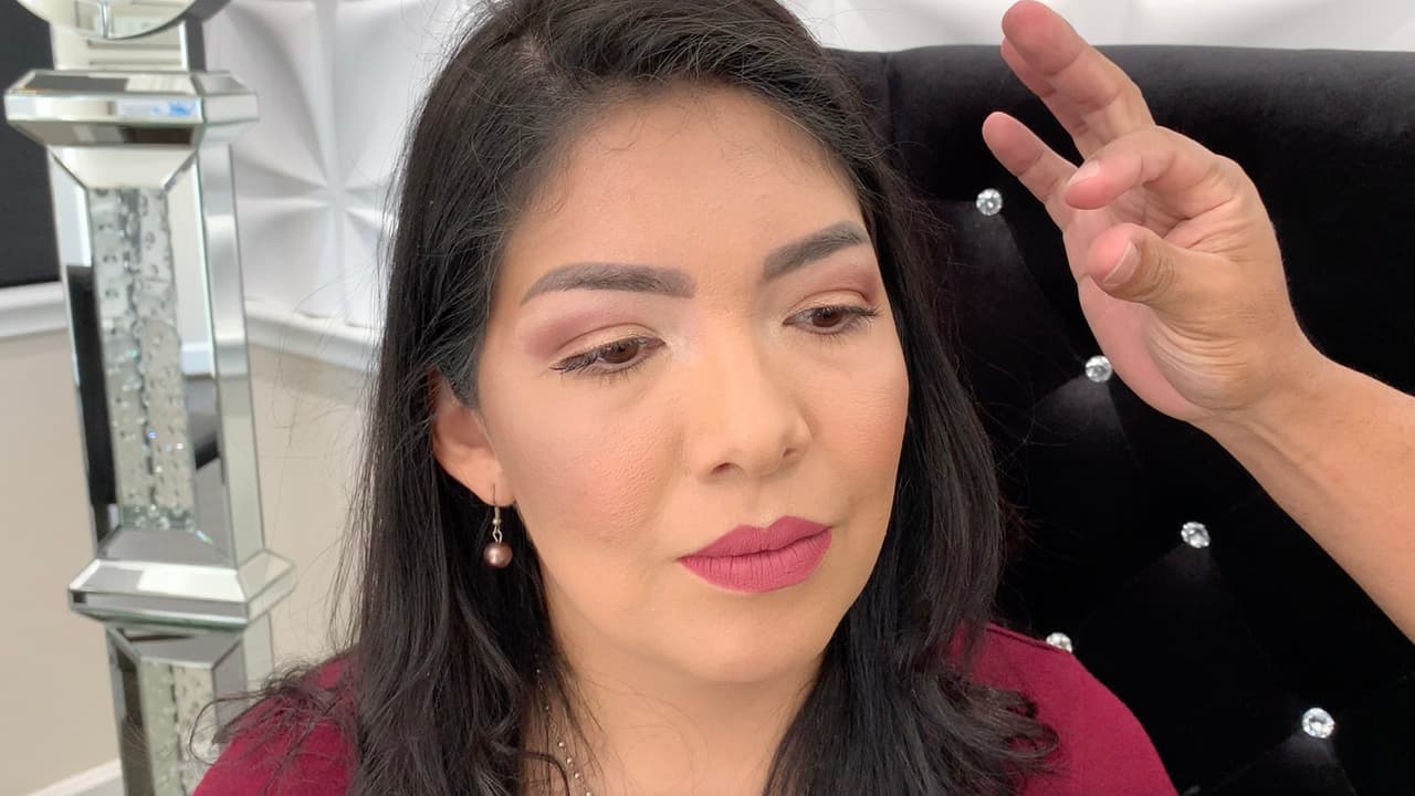 El primer procedimiento que le hicieron fue ‘microblanding’ con el cual quedó muy contenta.