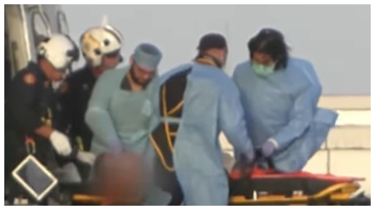 Un niño está hospitalizado tras caer del segundo piso de una casa en Doral 