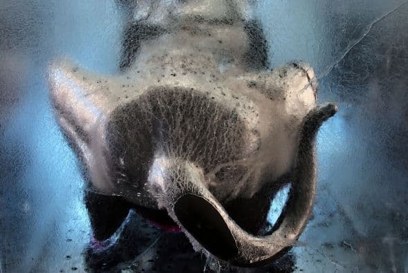 Tan sólo 20 mil perros son esterizados al año, en el Distrito Federal.