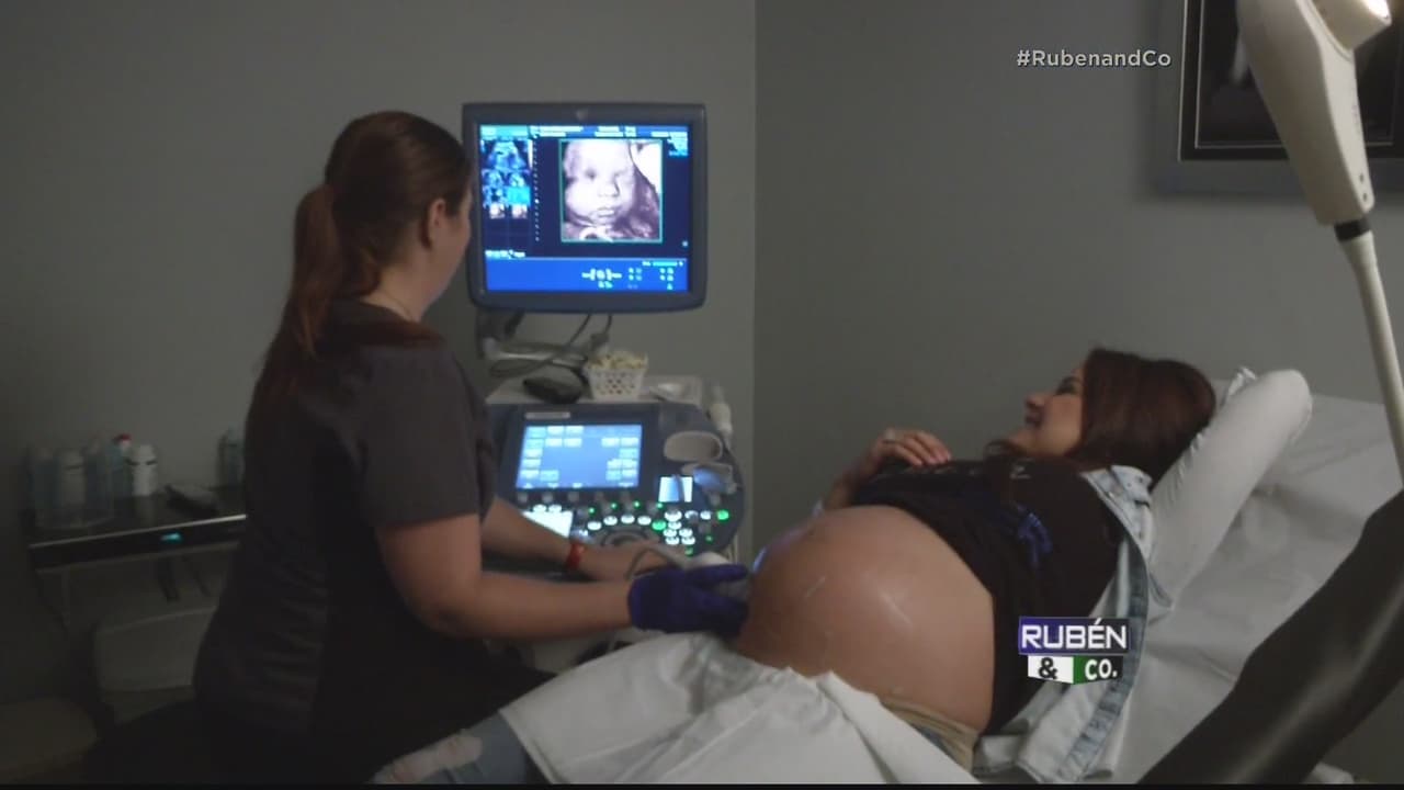 En Rubén & Co pudimos ver en 4D a #BabyCompany, la pequeña Kamilia que está en la barriguita de Gredmarie