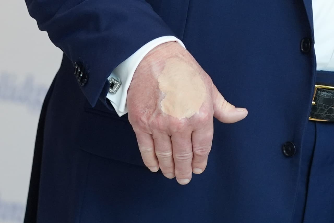 La mano del presidente Donald Trump mientras habla en el museo Casa del Pueblo, el viernes 22 de agosto de 2025, en Washington.