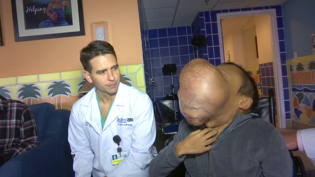 Cómo ayudar al niño cubano que tiene un enorme tumor en el rostro que amenaza su vida
 
