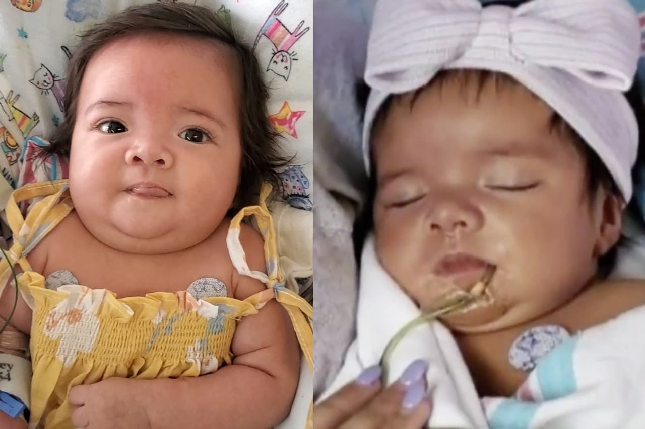 Con solo seis meses Janessa lucha para superar una enfermedad rara que afecta su sistema gástrico