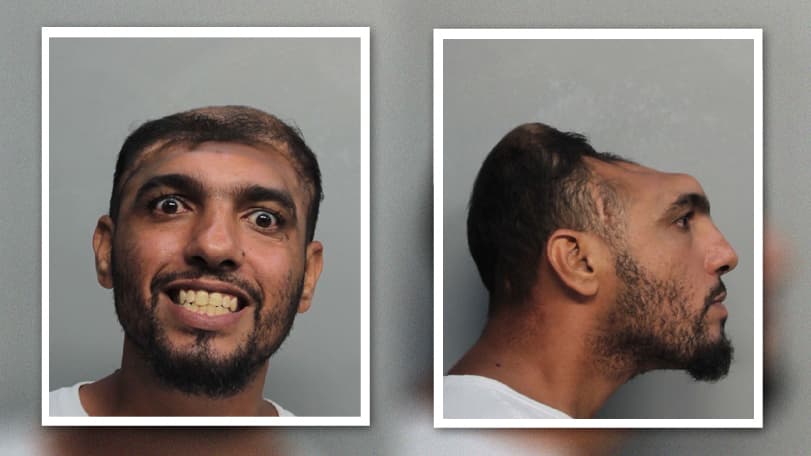 Hombre con 'media cabeza' es arrestado en Miami por intento de asesinato