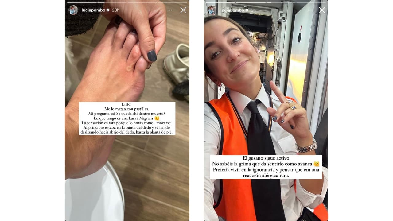 La 'influencer' Lucía Pombo reveló que tiene un gusano vivo en el pie.