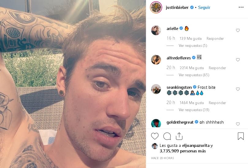 De hecho, Justin también presumió en su cuenta de Instagram un nuevo accesorio en su cuerpo con 
<b><a href="https://www.instagram.com/p/B0R14ZUn3c3/" target="_blank">esta foto.</a></b>