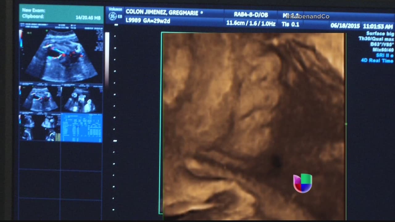 En Rubén & Co pudimos ver en 4D a #BabyCompany, la pequeña Kamilia que está en la barriguita de Gredmarie