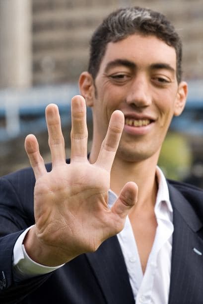 Estas dificultades derivan del hecho de que Kosen también tenga las extremidades más grandes del mundo, sus manos miden 27.5 centímetros y sus pies, 36.5 centímetros (equivalente a un número 60 de calzado).